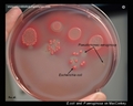 e.coli, p.aeruginosa, macconkey agar
